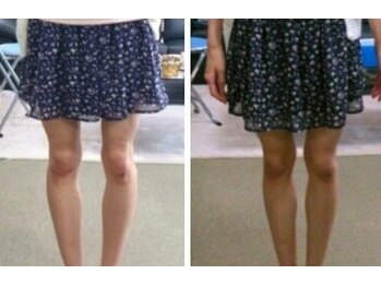 ウルオス/O・X脚を徹底的に改善