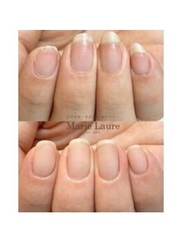 マリーロール 梅田店(Marie Laure)/自爪育成/深爪矯正/ネイルケア