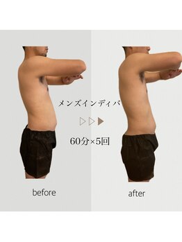 ファミーユ 名古屋店/【メンズインディバ】腰痛/脂肪