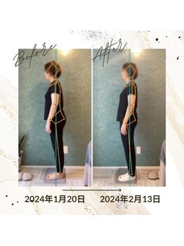 ラクリエ 東加古川院(La Creer)/お客様ビフォーアフター