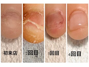 グレースレディ 神戸北店/