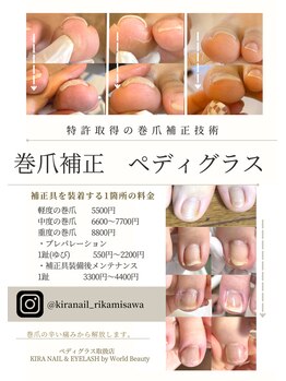 キラネイル アンド アイラッシュ by World Beauty(KIRA)/巻爪補正 ペディグラス