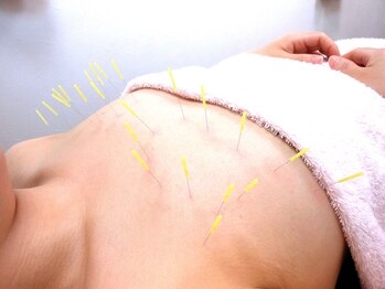 一丁目治療院/美乳鍼