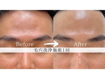 ナチュラル グロウ 木更津(NATURAL GLOW)/メンズフェイシャル