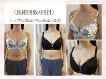バスト鍼ラボ 代々木上原(BUST 鍼LAB.)の雰囲気（施術4回目のお客様お悩み:下垂）