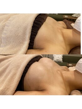 IBC 上大岡店/Before-After