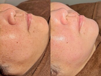 ルーナジェーナ(Luna llena)/池袋 エステ ルーナジェーナ