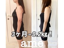 エイム(ame)/耳つぼ/痩身/ダイエット/豊田市