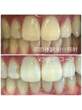 ホワイトニングルーム 横浜店(Whitening Room)/ホワイトニング/横浜