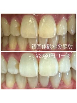 ホワイトニングルーム 横浜店(Whitening Room)/ホワイトニング/横浜