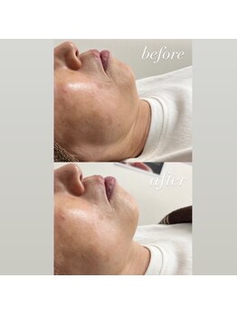 スマイルネイル(SMILE NAIL)/