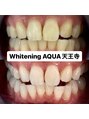 アクア 天王寺店(AQUA) ホワイトニング/ホワイトニング専門店/天王寺/ホワイトニング