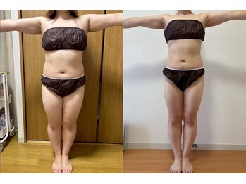 ヨサパーク ドゥー 駒沢公園(YOSA PARK deux)/痩身/ダイエット/よもぎ蒸し痩身