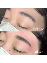 アーティカル(Artical)/アイブロウリフト