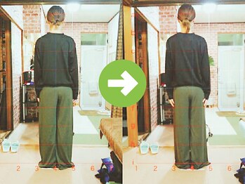 サプライズ整体院/20代ママの初回産後の骨盤矯正