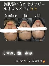 リツイート(ReTweet)/ララピール艶肌・美白・くすみ