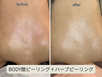 ヴェールココン(Veil Cocon)/