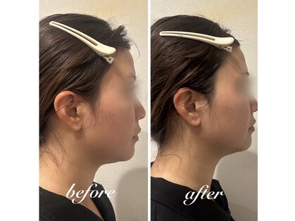 サワヤカ(SAWAYAKA)の写真