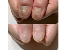 アティックネイルアトリエ(attic nail atelier)