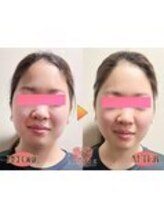 ヴィオーデ美容整体サロン 川越店/小顔、リンパ、ヘッドスパ、整体