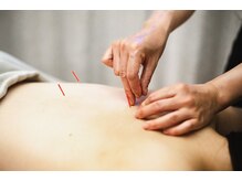 サルビア(SALVIA)/施術シーン３　鍼灸