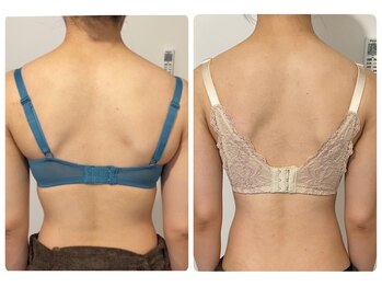 モナンジュ(ramonange)/バストアップbefore after