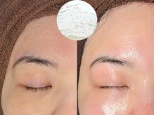 ルーナジェーナ(Luna llena)/池袋　エステ　ルーナジェーナ