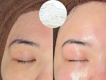 ルーナジェーナ(Luna llena)/池袋　エステ　ルーナジェーナ