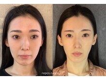 ルポナゴヤ(repos.nagoya)/