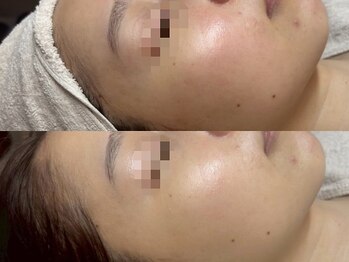 リスト(Rist TOTAL BEAUTY)/LDM