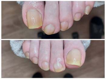 皮膚科では切ってくれなくて…