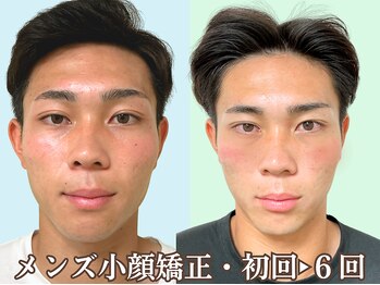 ナチュラルパーフェクトフェイス 新宿の写真/骨格バランスを整え、フェイスラインを引き締めるMen’s小顔矯正×印象改善スペシャル
