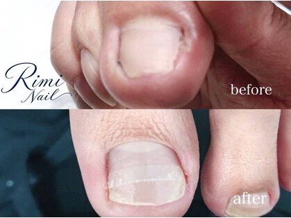 リミネイル 下北沢(Rimi Nail)の写真