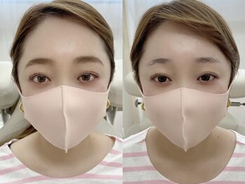 シャルエ アイサロン(Charer)/eyebrow×lashlift