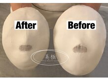 美極 トータルビューティー(美極 TOTAL BEAUTY)/恵比寿/小顔コルギ/エステ/