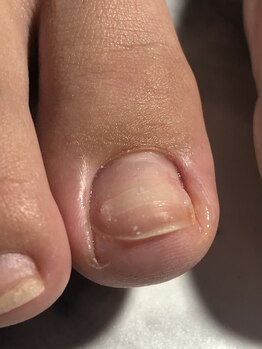 トゥーネイル(02nail)/