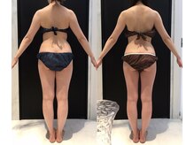 リボディ 表参道(An re Body)/before→after