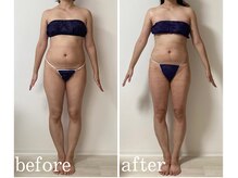 カリス/全身8回ビフォーアフター