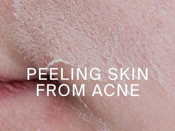 アステキ(ASUTEKI)/日本代理店☆ヴィーガン認定品