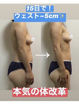 Ms.やまとなでしこ 明石店/全身リフトアップ15日後の変化