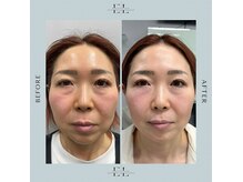 モア(eyelash salon MOOR)