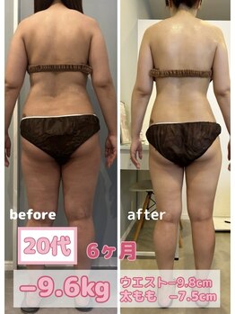 サロン ド フェイス モアナ(Salon de Faith Moana)/キャビテーション痩身【20代】