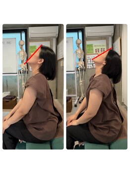 香椎井上整骨 整体院/肩こり・首こり・頭痛・不眠