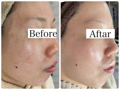 リラビューティー(Lilas Beauty)の写真