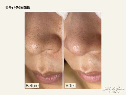 シルク ド リバー 銀座店(Silk de River)の写真