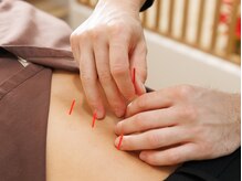 アイ鍼灸整骨院 平塚店/鍼灸師在籍