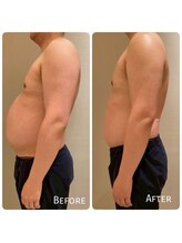 ククナ 上越店(KUKUNA)/40代男性（姿勢矯正１回）