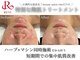 フェイシャルヴィム(FACIAL VIM)の写真