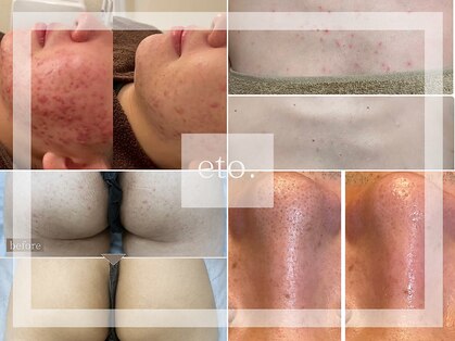 エト(eto.)の写真