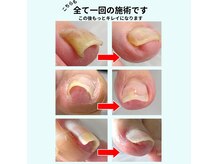 巻き爪専門院002 二俣川の雰囲気（巻き爪/陥入爪/深爪/変形爪お気軽にご相談ください^ ^）